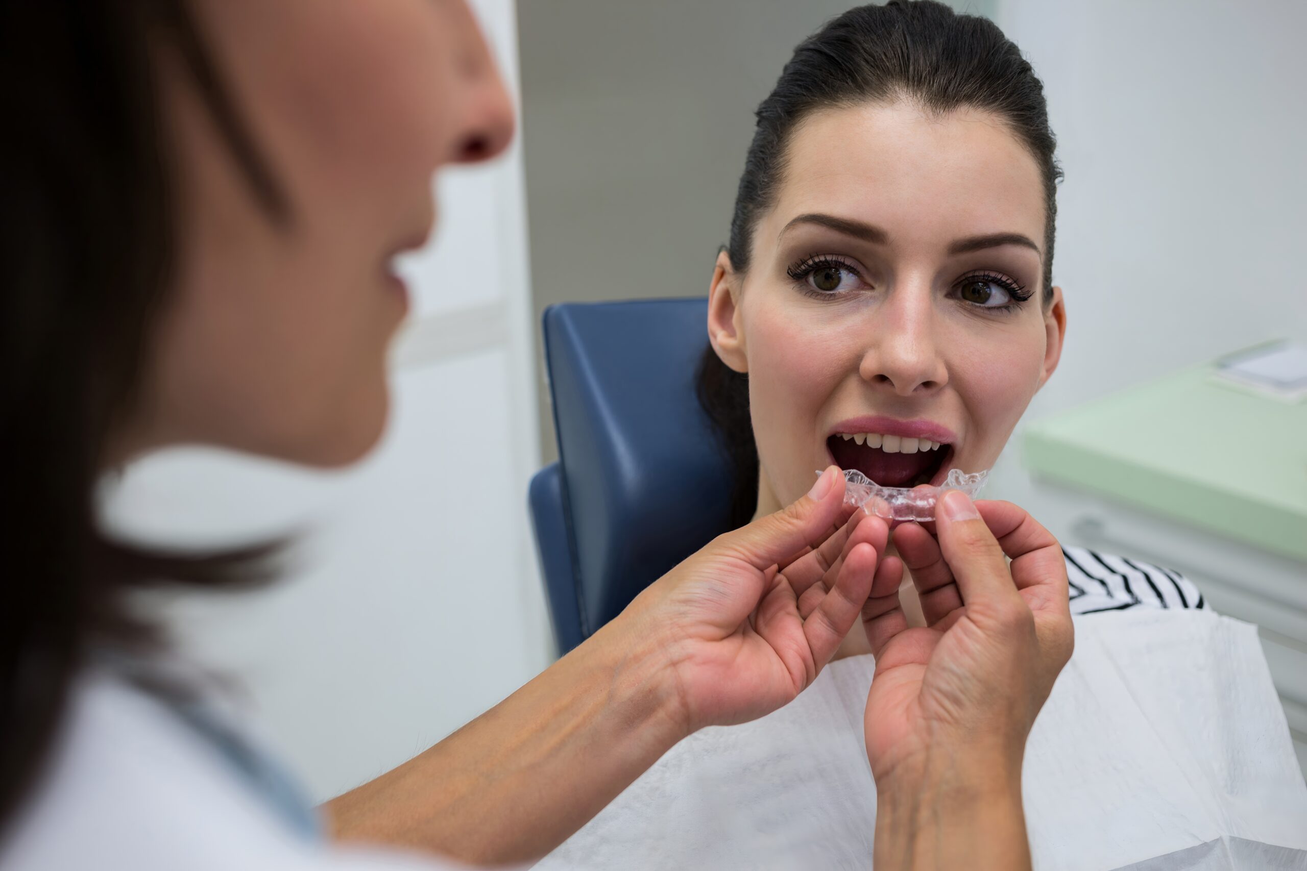 Benefits of Clear Braces